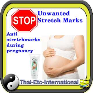 ANTI STRETCH MARK CREAM during pregnancy Remover Reducing lines scars 