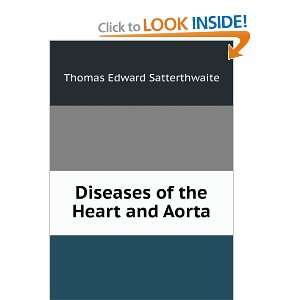   of the Heart and Aorta Thomas Edward Satterthwaite  Books