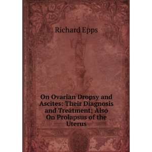   and Treatment; Also On Prolapsus of the Uterus Richard Epps Books