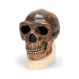  Anthropological Skull Model   Sinanthropus Health 