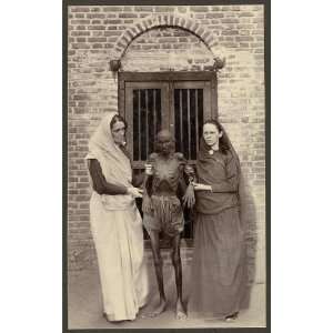  Miss Neil,famine victim,emaciated,starve,India,c1900